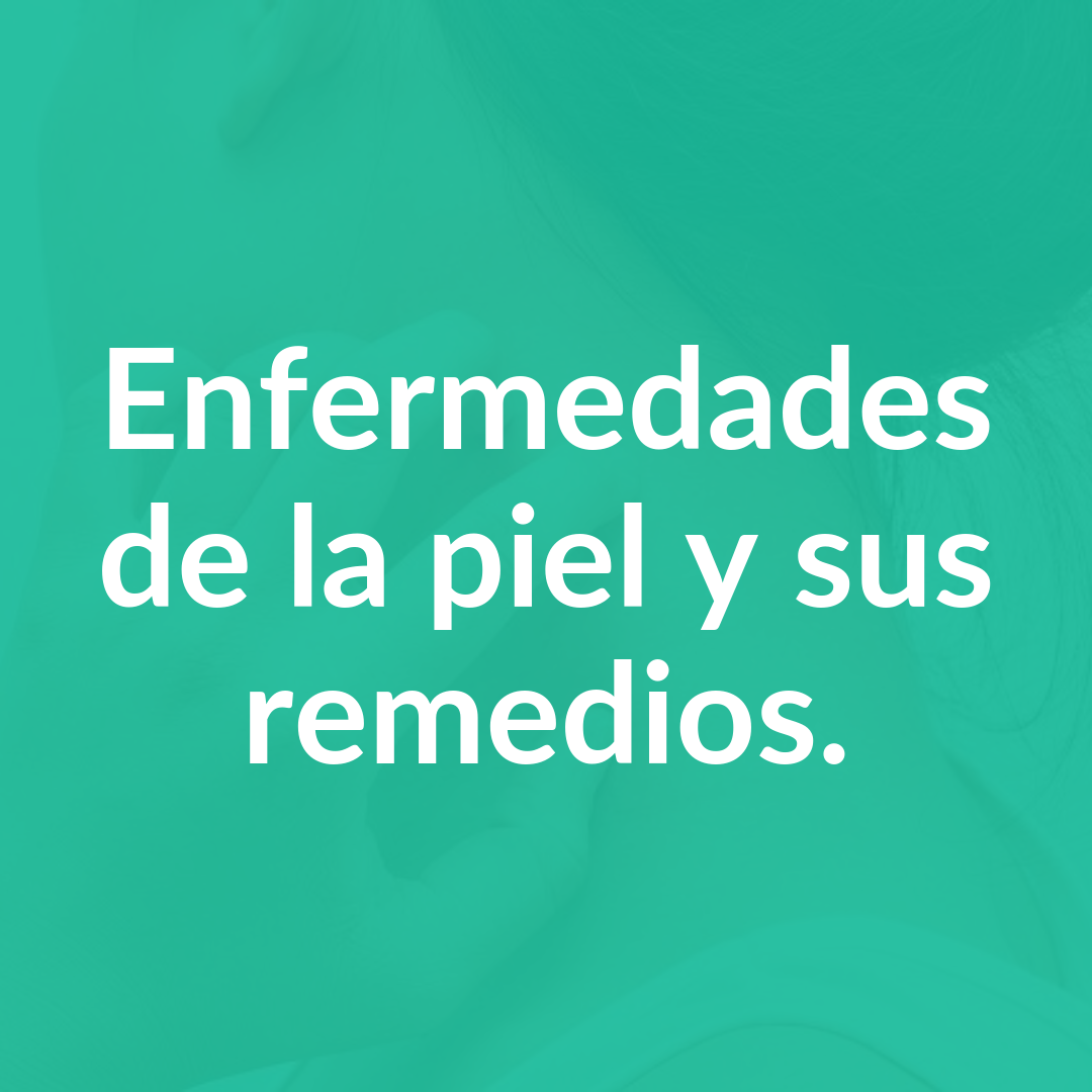 ALERGIAS (14)